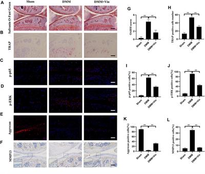 Vindoline Attenuates Osteoarthritis Progression Through Suppressing the NF-κB and ERK Pathways in Both Chondrocytes and Subchondral Osteoclasts